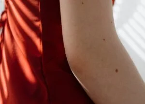 lightning dark elbow