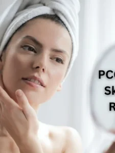 PCOS Acne Skin Care Routine