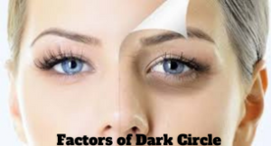 Causes of dark circles under the eyes