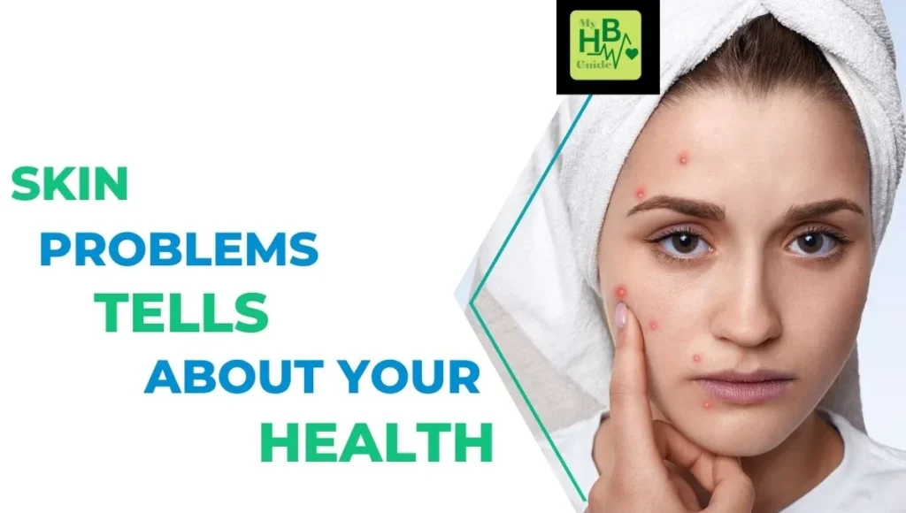Skin Problems Tells About Your Health
