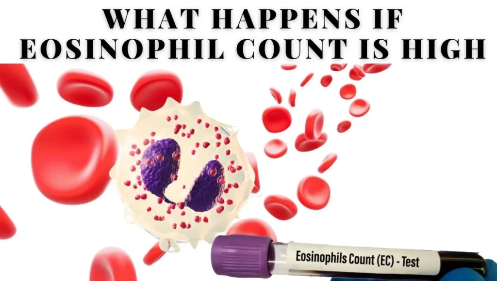 What happens if eosinophil count is high