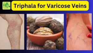 Triphala for Varicose Veins