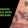 Common Penile Skin Problems