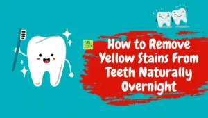 How to Remove Yellow Stains From Teeth Naturally