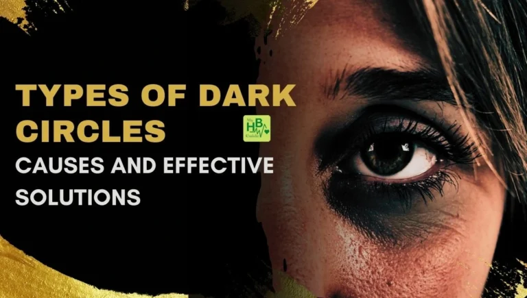 Types of Dark Circles: Causes