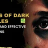 Types of Dark Circles: Causes
